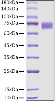 Recombinant Mouse Fc-epsilon RI-alpha/FCER1A Protein was determined by SDS-PAGE under reducing conditions with Coomassie Blue.