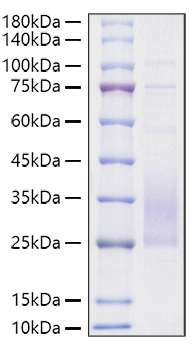 Recombinant Mouse TREM2 Protein was determined by SDS-PAGE under reducing conditions with Coomassie Blue.