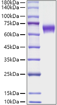 Recombinant Mouse TNFRSF9/4-1BB/CD137 Protein was determined by SDS-PAGE under reducing conditions with Coomassie Blue.