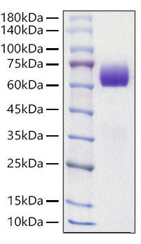 Recombinant Mouse Tyrosine-protein kinase receptor UFO/Axl Protein was determined by SDS-PAGE under reducing conditions with Coomassie Blue.