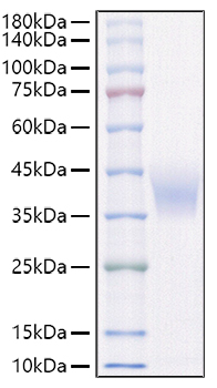 Recombinant Rat IL-4R alpha/CD124 Protein was determined by SDS-PAGE under reducing conditions with Coomassie Blue.