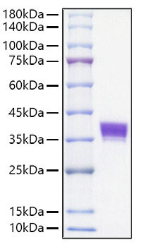 Recombinant Mouse Ep-CAM/TROP-1/CD326 Protein was determined by SDS-PAGE under reducing conditions with Coomassie Blue.