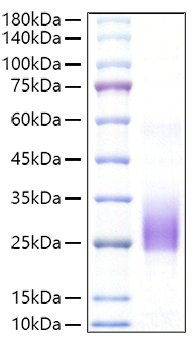 Recombinant Mouse BY55/CD160 Protein was determined by SDS-PAGE under reducing conditions with Coomassie Blue.
