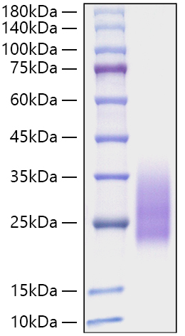 Recombinant Monkeypox virus A30L Protein was determined by SDS-PAGE under reducing conditions with Coomassie Blue.