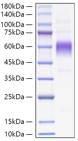 Recombinant Monkeypox virus B16R Protein was determined by SDS-PAGE under reducing conditions with Coomassie Blue.