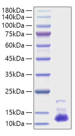Recombinant Human CXCL7/PPBP Protein was determined by SDS-PAGE under reducing conditions with Coomassie Blue.