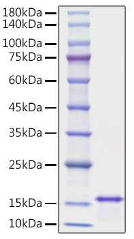 Recombinant Human IL-2 Protein was determined by SDS-PAGE under reducing conditions with Coomassie Blue.