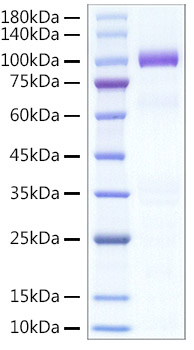 Recombinant Human Hepatocyte growth factor/HGF Protein was determined by SDS-PAGE under reducing (R) and non-reducing (NR) conditions.