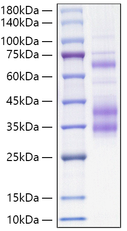 Recombinant Mouse Clusterin/Apo-J/CLU Protein was determined by SDS-PAGE under reducing conditions with Coomassie Blue.