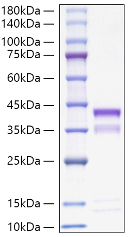 Recombinant Mouse Cathepsin S/CTSS Protein was determined by SDS-PAGE under reducing conditions with Coomassie Blue.