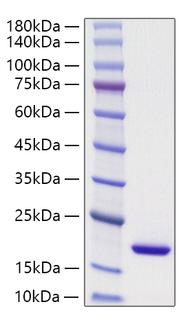 Recombinant Mouse PPIase A/PPIA Protein was determined by SDS-PAGE under reducing conditions with Coomassie Blue.