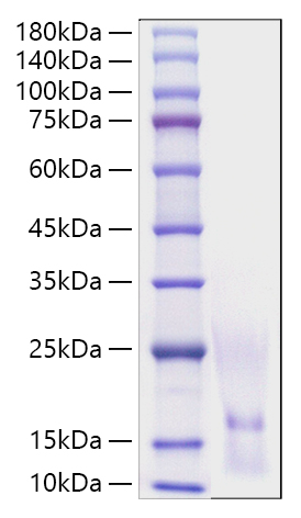 Recombinant Human CCL1/I-309 Protein was determined by SDS-PAGE under reducing conditions with Coomassie Blue.
