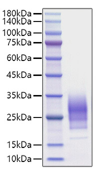 Recombinant Human IL-22 Protein was determined by SDS-PAGE under reducing conditions with Coomassie Blue.