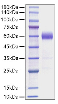 Recombinant Mouse IL-22 Protein was determined by SDS-PAGE under reducing conditions with Coomassie Blue.