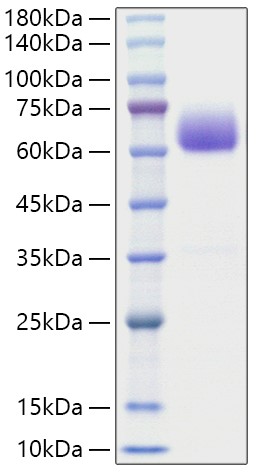 Recombinant Mouse BTLA/CD272 Protein was determined by SDS-PAGE under reducing conditions with Coomassie Blue.