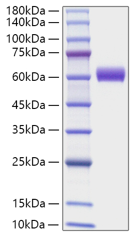 Recombinant Mouse Angiotensinogen/AGT Protein was determined by SDS-PAGE under reducing conditions with Coomassie Blue.