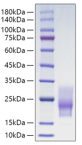Recombinant Human CD63 Protein was determined by SDS-PAGE under reducing conditions with Coomassie Blue.