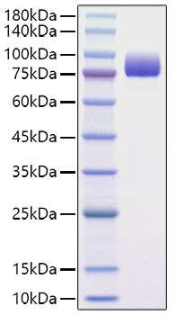 Recombinant Human Afamin/AFM Protein was determined by SDS-PAGE under reducing conditions with Coomassie Blue.