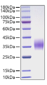 Recombinant Mouse Oncostatin-M/OSM Protein was determined by SDS-PAGE under reducing conditions with Coomassie Blue.