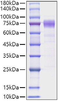 Recombinant Human IL-10RA/CD210 Protein was determined by SDS-PAGE under reducing conditions with Coomassie Blue.