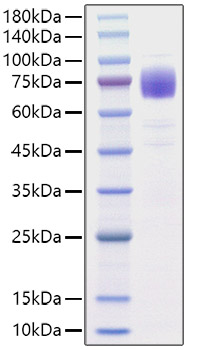 Recombinant Human IL-10RA/CD210 Protein was determined by SDS-PAGE under reducing conditions with Coomassie Blue.