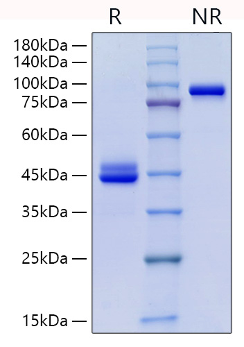 Recombinant Human CD9 Protein was determined by SDS-PAGE under reducing (R) and non-reducing (NR) conditions.