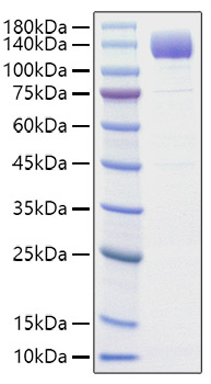 Recombinant Rat VEGFR-2/KDR/CD309 Protein was determined by SDS-PAGE under reducing conditions with Coomassie Blue.