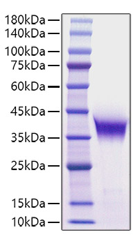 Recombinant Human/Mouse FGF-8B Protein was determined by SDS-PAGE under reducing conditions with Coomassie Blue.