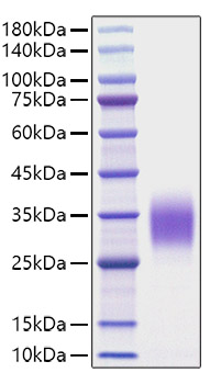 Recombinant Rat IL-9 Protein was determined by SDS-PAGE under reducing conditions with Coomassie Blue.