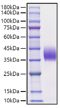 Recombinant Mouse B7-DC/PD-L2/CD273 Protein was determined by SDS-PAGE under reducing conditions with Coomassie Blue.