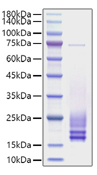 Recombinant Rat Cystatin-C/CST3 Protein was determined by SDS-PAGE under reducing conditions with Coomassie Blue.