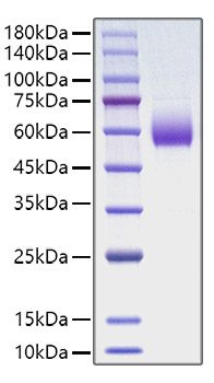 Recombinant Rat CD47 Protein was determined by SDS-PAGE under reducing conditions with Coomassie Blue.