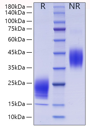 Recombinant Mouse IL-5 Protein was determined by SDS-PAGE under reducing (R) and non-reducing (NR) conditions.