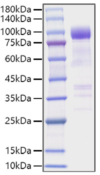 Recombinant Mouse IL1RL1/ST2 Protein was determined by SDS-PAGE under reducing conditions with Coomassie Blue.