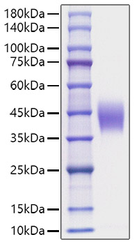 Recombinant Mouse IL-4R alpha/CD124 Protein was determined by SDS-PAGE under reducing conditions with Coomassie Blue.