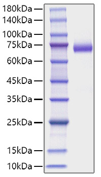 Recombinant Mouse DLL4 Protein was determined by SDS-PAGE under reducing conditions with Coomassie Blue.