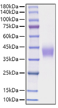 Recombinant Mouse B7-H3/CD276 Protein was determined by SDS-PAGE under reducing conditions with Coomassie Blue.