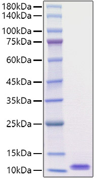 Recombinant Mouse EGF Protein was determined by SDS-PAGE under reducing conditions with Coomassie Blue.