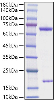 Recombinant Rat PCSK9 Protein was determined by SDS-PAGE under reducing conditions with Coomassie Blue.