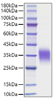 Recombinant Human IL-9 Protein was determined by SDS-PAGE under reducing conditions with Coomassie Blue.