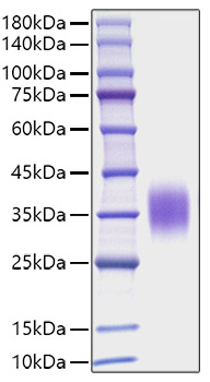 Recombinant Mouse IL-9 Protein was determined by SDS-PAGE under reducing conditions with Coomassie Blue.