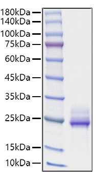 Recombinant Human IL-6 Protein was determined by SDS-PAGE under reducing conditions with Coomassie Blue.