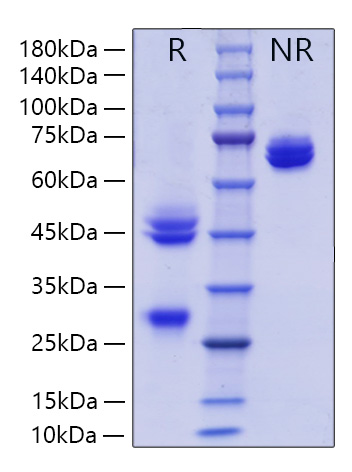 Recombinant Mouse IL-12/IL-12A&amp;IL-12B Protein was determined by SDS-PAGE under reducing (R) and non-reducing (NR) conditions.