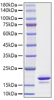 Recombinant Human Alpha-synuclein/SNCA Protein was determined by SDS-PAGE under reducing conditions with Coomassie Blue.