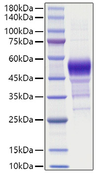 Recombinant Human Betacellulin/BTC Protein was determined by SDS-PAGE under reducing conditions with Coomassie Blue.