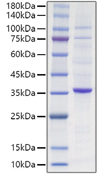 Recombinant Human Proliferating cell nuclear antigen/PCNA Protein was determined by SDS-PAGE under reducing conditions with Coomassie Blue.