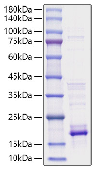 Recombinant Human IL-21 Protein was determined by SDS-PAGE under reducing conditions with Coomassie Blue.