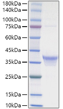 Recombinant Human IL-34 Protein was determined by SDS-PAGE under reducing conditions with Coomassie Blue.