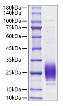 Recombinant Rat IL-7 Protein was determined by SDS-PAGE under reducing conditions with Coomassie Blue.
