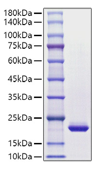 Recombinant Human CSF-3/G-CSF Protein was determined by SDS-PAGE under reducing conditions with Coomassie Blue.